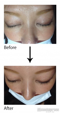 「EYE LASH UP（アイラッシュ ユー・ピー）」使用前と使用後