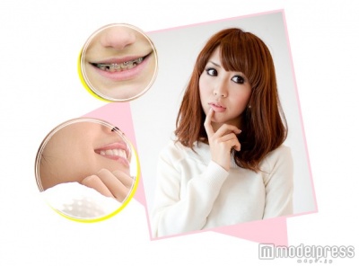 モテたいならココが肝心！初対面で大きな影響を与えるパーツって？／画像提供：歯並びスマイル