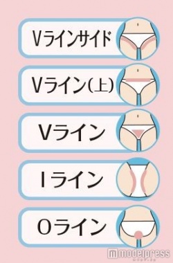 新・脱毛エステサロン「KIREIMO」ではデリケートゾーンの全体の脱毛が可能。