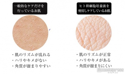 「ヒト幹細胞培養液」で肌の内側からしっかりケア