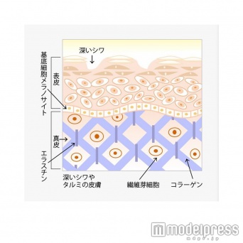お肌がハリを失った状態