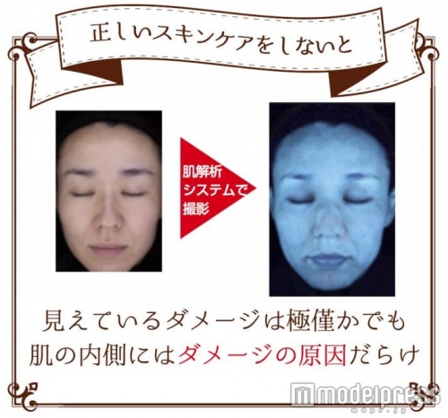 間違ったスキンケアは肌ダメージの原因になるので要注意！