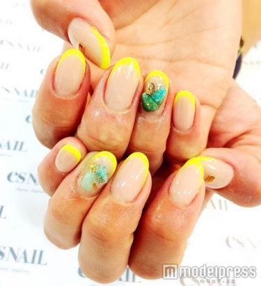 イエローフレンチ／画像提供：esNAIL