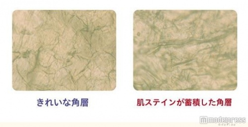 「肌ステイン」は、活性酸素が角層のたんぱく質に付着し、酸化した肌の黄ばみ。