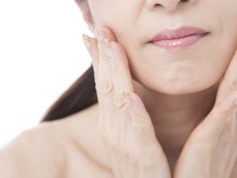 ニキビ,ワセリン