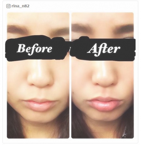 簡単に唇がふっくら／sara_mproさんinstagramより