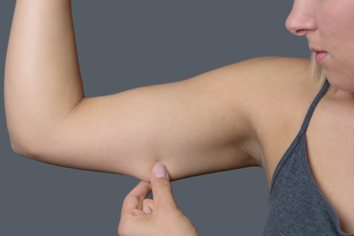 二の腕をつまんでいる女性の写真