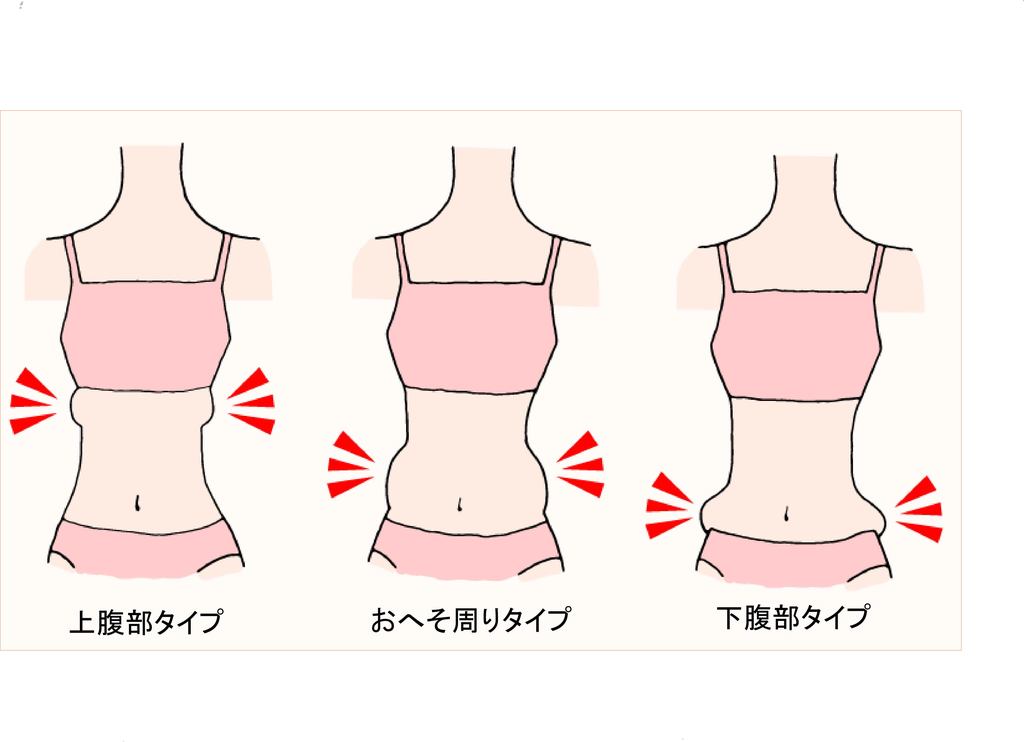 脂肪のつき方をタイプ別にした図