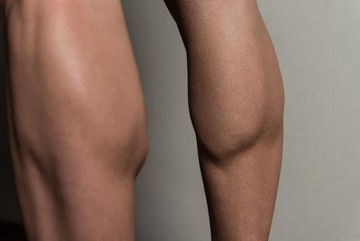 ふくらはぎの筋肉の写真