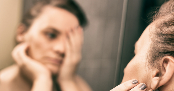 放っておくとシミにも！ニキビ跡を消す方法とは？