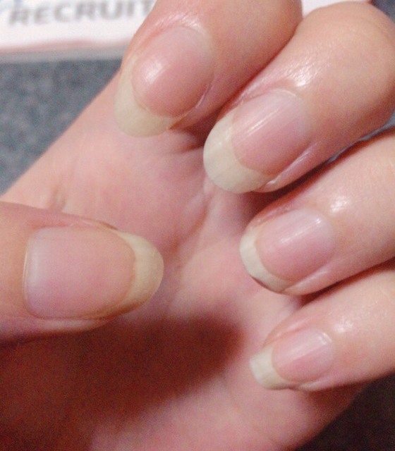 ふと目についた自分の指先・・・