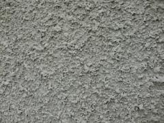 見えてないの自分だけ！！”黒ずみザラザラひじ”にみんなの視線が集まってるかも…