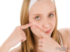 ほっぺたポツリ…大人ニキビの4つの疑問を解決！