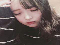 絶対に治ります。悪質ニキビと1週間でおさらばしましょう！