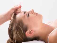 美肌＆小顔に近づく!? 肌本来の力を引き出す「美容鍼」のパワー