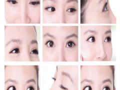 一重と二重は筋肉量が違う？ まぶたの正しい情報を医師が解説