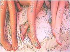 うっかり日焼け肌を今すぐ白雪肌に？”即効性重視”の美白アイテム8つ♡