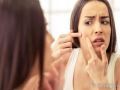 跡を残したくない！大人ニキビの正しいケア