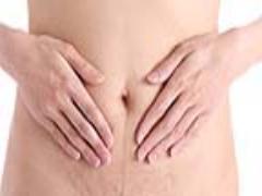 妊娠線ができてしまった！ あきらめずに消す方法