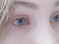 まだ気づいていないだけかも。見落としがちな目元のたるみを改善してパッチリ目に