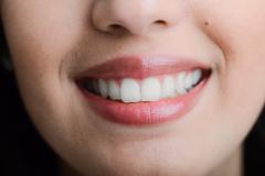 笑顔になるとシワは濃くなるの！？ほうれい線を防ぐには・・・