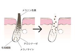 アラサーになったら知っておきたい！白髪予防＆見つけたときの対処法 |