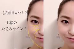 頬の毛穴が目立つ！それって「お顔全体のたるみサイン」って知ってた？