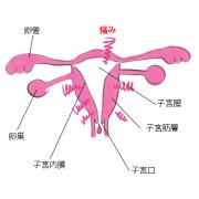 毎月悩む生理痛…そもそも起こる原因、知ってる？ |
