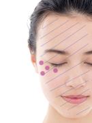 夏のうっかり日焼けをなかったことに！ シミ・くすみのもとを一掃するホームケア方法をプ