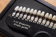 白い歯を目指そう♡話題のお得なセルフホワイトニングとは？ -