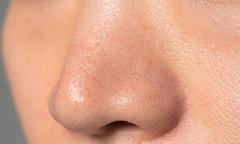 鼻の角栓を除去したいなら！｜鼻の角栓・黒ずみを目出せない方法＆おすすめパック・ケア