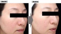 シェービングとは？おすすめシェービングアイテム＆やり方 |