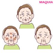 乾燥タイプをチェックリストで診断！ あなたに足りないのは水？ 油？ |