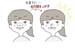 憧れのつるつる小鼻に。毛穴ケアの神コスメTOP3 | ビューティーガールからの美容・美肌情報