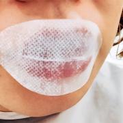 唇の黒ずみは肌色が沈んで老け顔印象に…うるぷるリップを復活させるサロン＆セルフケア