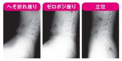 整形外科医が伝授！ 長く座っても体に負担をかけず疲れない「ゼロポジ座り」とは？ |