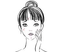 顎ニキビ退治！大人が繰り返す顎ニキビの原因とは？痛い・かゆい時の対策やお薬・食べ物