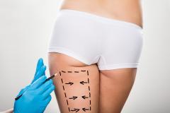 毎日コツコツ筋肉を刺激！ 太ももがどんどん痩せる運動とは？|＠ビューティーガール