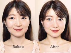 美容矯正で小顔に！美的クラブが超人気サロンの小顔美容矯正＆酵素オイルフェイシャルを