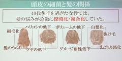 ミルボンの若手研究者の大発見！頭皮の加齢指標のひとつは…なんと「老化菌」だった |