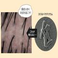 ストレスによる薄毛対策｜抗炎症ケア＆頭筋リリースマッサージで薄毛ケアを！ |
