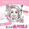 効果は？ 痛い？ 費用は？ 実際どうなの？ 【大人の歯列矯正】 | ビューティーガール(beaut
