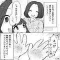 お風呂上がりの娘に“保湿ケア”…「手を出して～…ってなにこれ！？」両手に無数の水ぶ